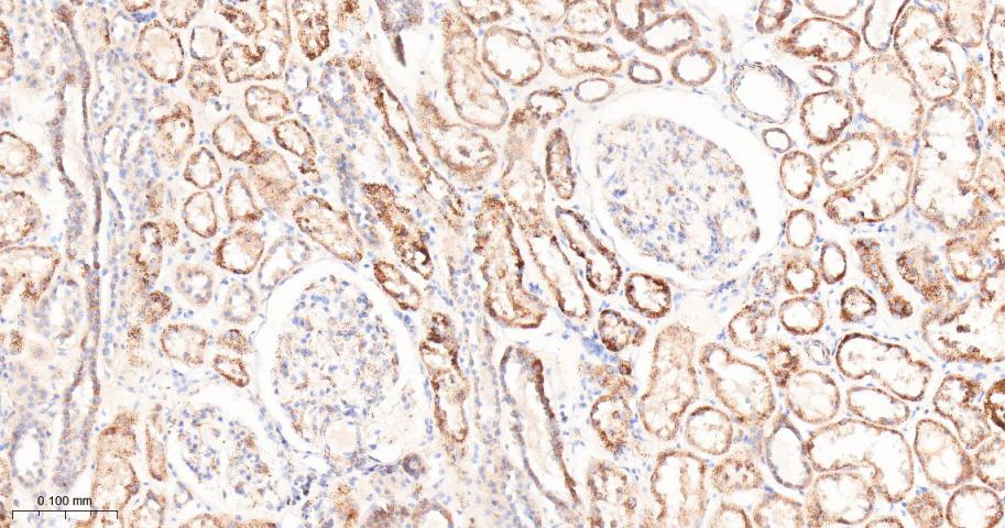 肿瘤坏死因子α诱导蛋白3重组兔单抗