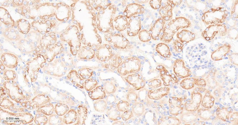 核糖体蛋白S3重组兔单抗