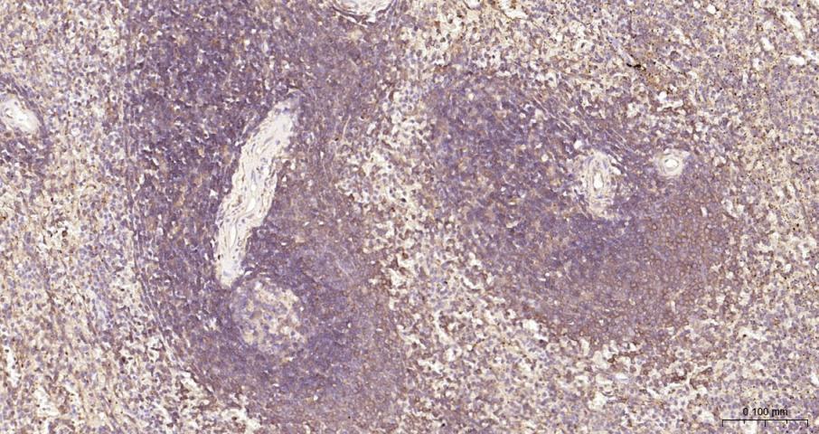 细胞核因子/k基因结合核因子抗体-bs-20160R