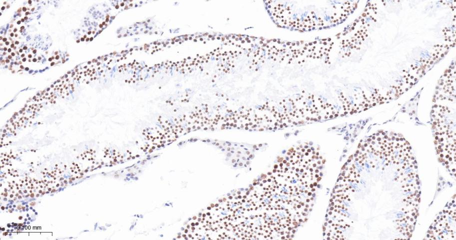 组蛋白去乙酰化酶1（核内参）重组兔单抗