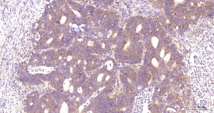 细胞核因子/k基因结合核因子抗体-bs-20160R