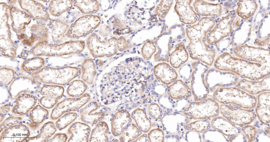 乙酰辅酶A羧化酶重组兔单抗