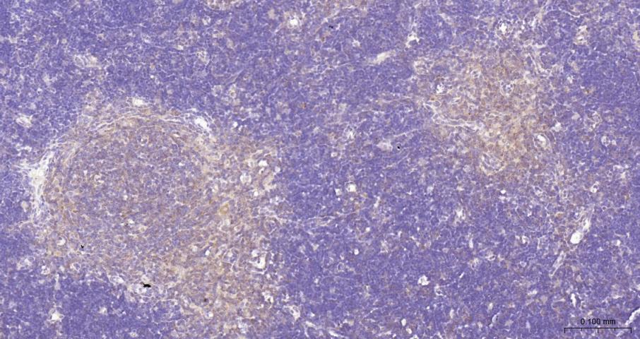 细胞核因子/k基因结合核因子抗体-bs-20160R