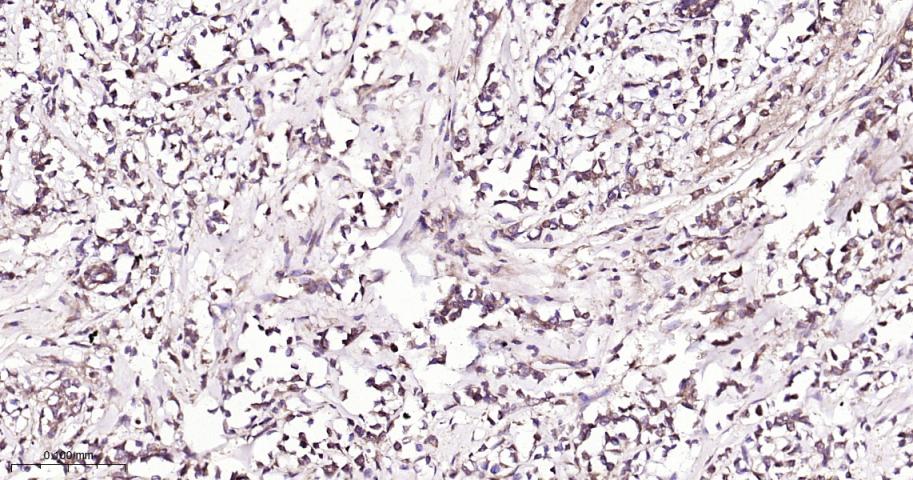 细胞核因子/k基因结合核因子单克隆抗体-bsm-33117M