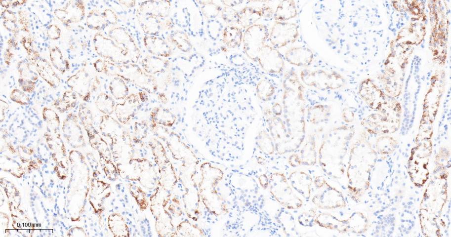 核糖体蛋白S3重组兔单抗