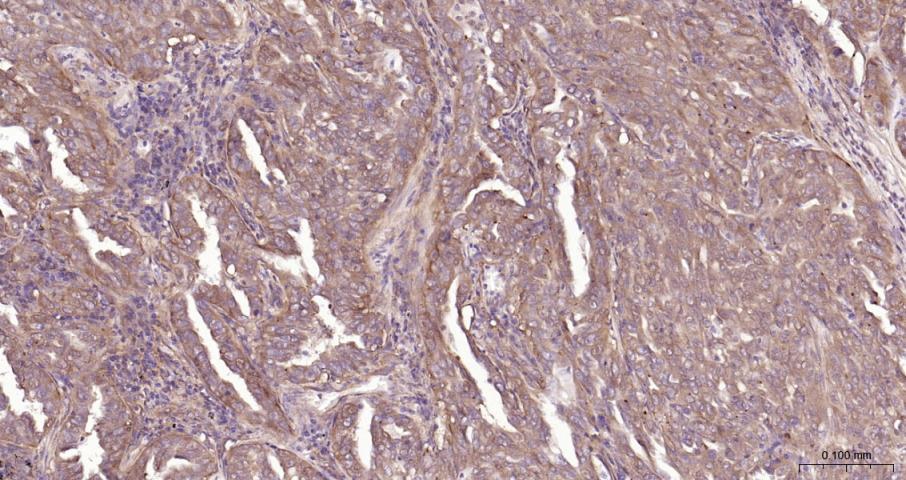 细胞核因子/k基因结合核因子抗体-bs-20160R