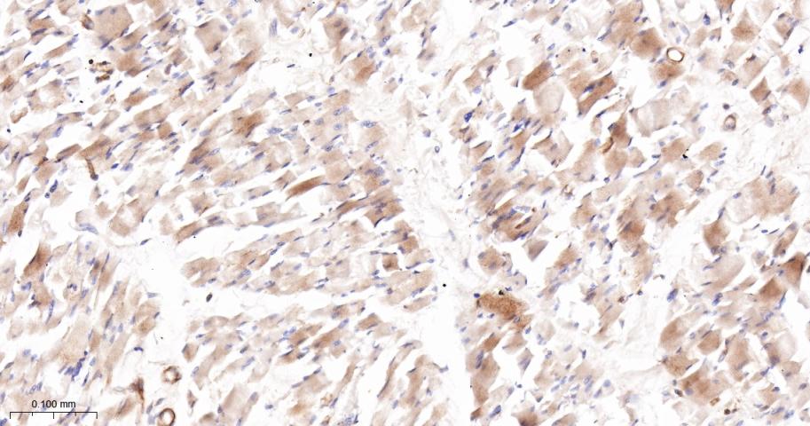 乙酰辅酶A羧化酶重组兔单抗
