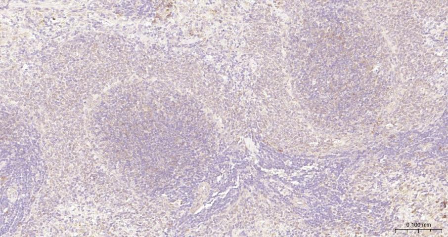 细胞核因子/k基因结合核因子抗体-bs-20160R