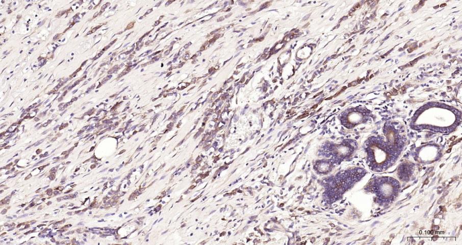 细胞核因子/k基因结合核因子抗体-bs-20160R