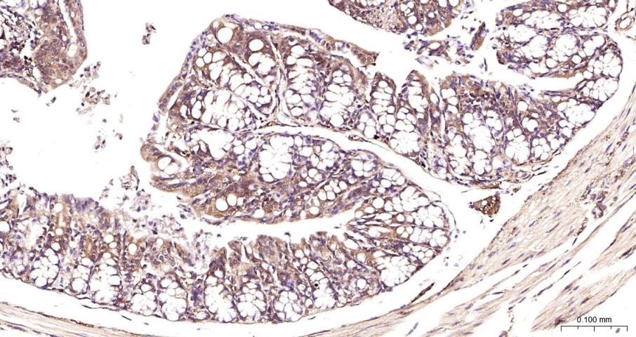 细胞核因子/k基因结合核因子抗体-bs-20160R