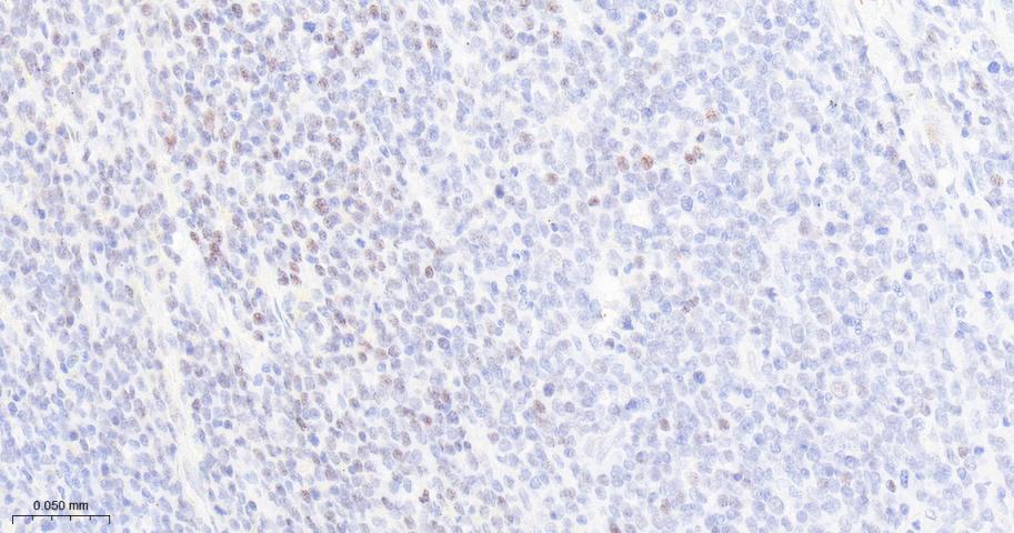 组蛋白去乙酰化酶1（核内参）重组兔单抗