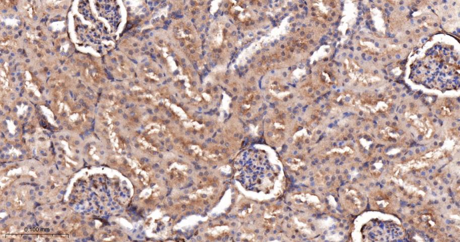 乙酰辅酶A羧化酶重组兔单抗