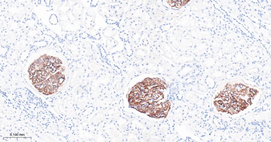 肾小球裂孔膜蛋白PDCN重组兔单抗