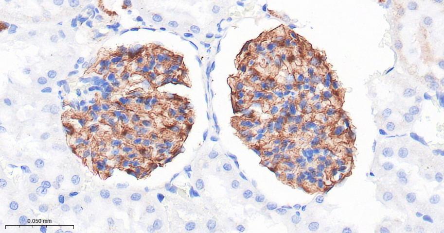 肾小球裂孔膜蛋白PDCN重组兔单抗