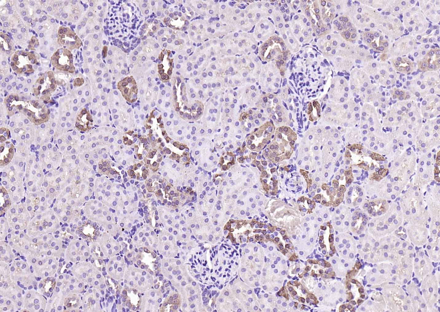 钙结合蛋白D28K抗体-bs-3758R