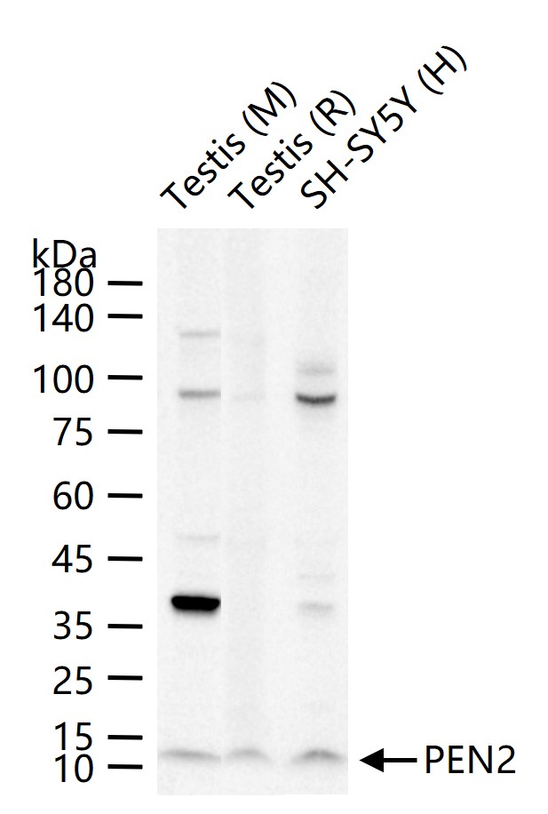 PEN2 Recombinant Rabbit mAb (一抗) - WB,IHC-P,IHC-F,IF,Flow-Cyt,ICC/IF | Bioss