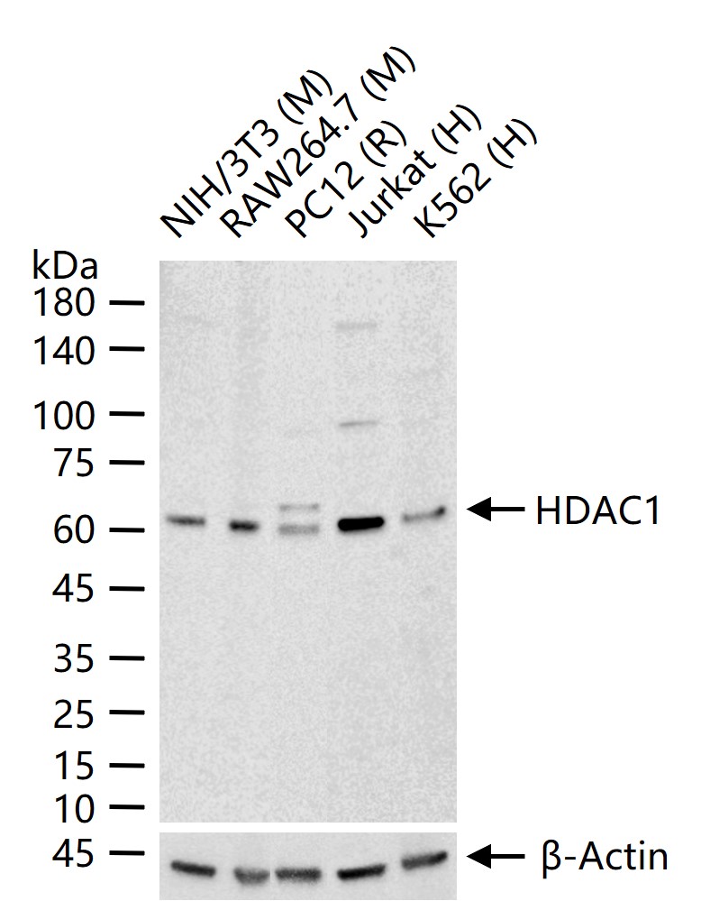 组蛋白去乙酰化酶1（核内参）重组兔单抗