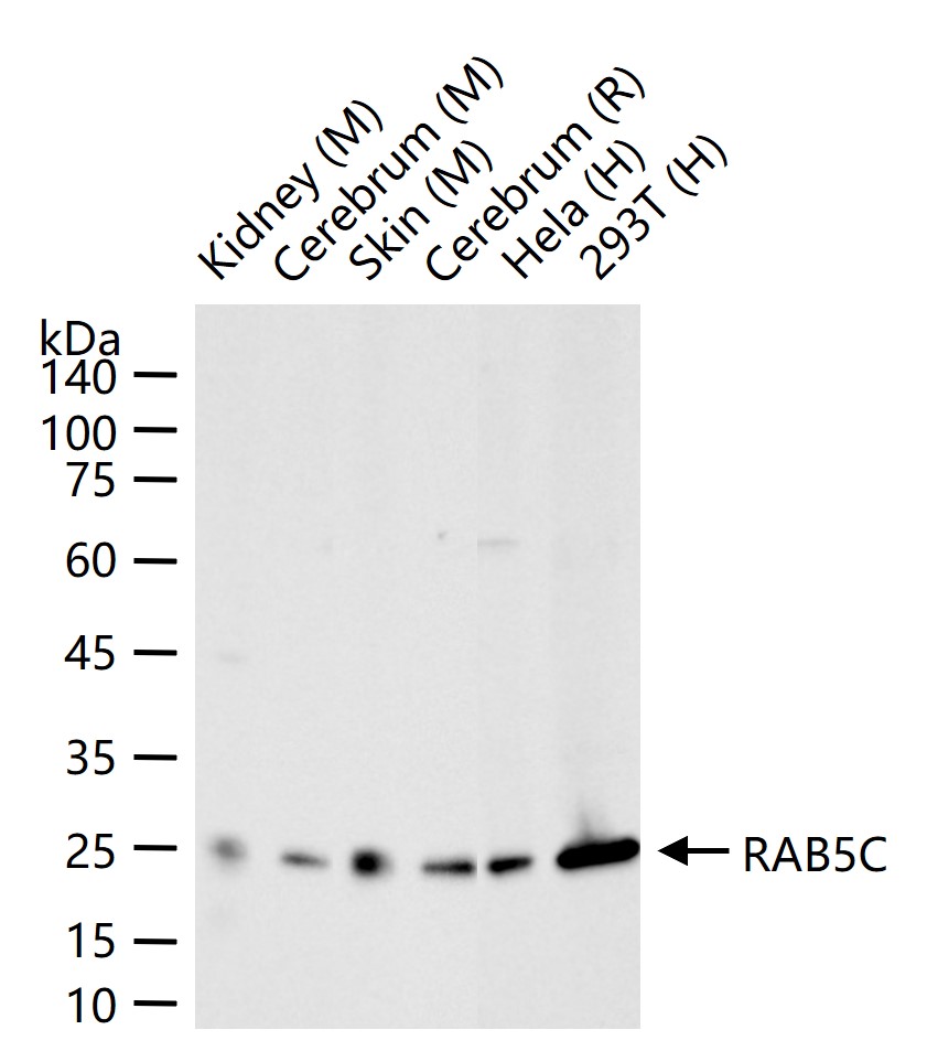 RAB5C Recombinant Rabbit mAb (一抗) - WB,IHC-P,IHC-F,ICC/IF,IF | Bioss