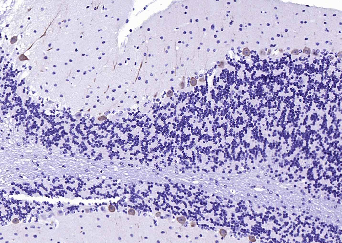 钙结合蛋白D28K抗体-bs-3758R