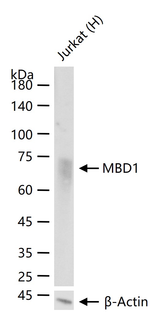 MBD1 Recombinant Rabbit mAb (一抗) - WB,IHC-P,IHC-F,IF | Bioss