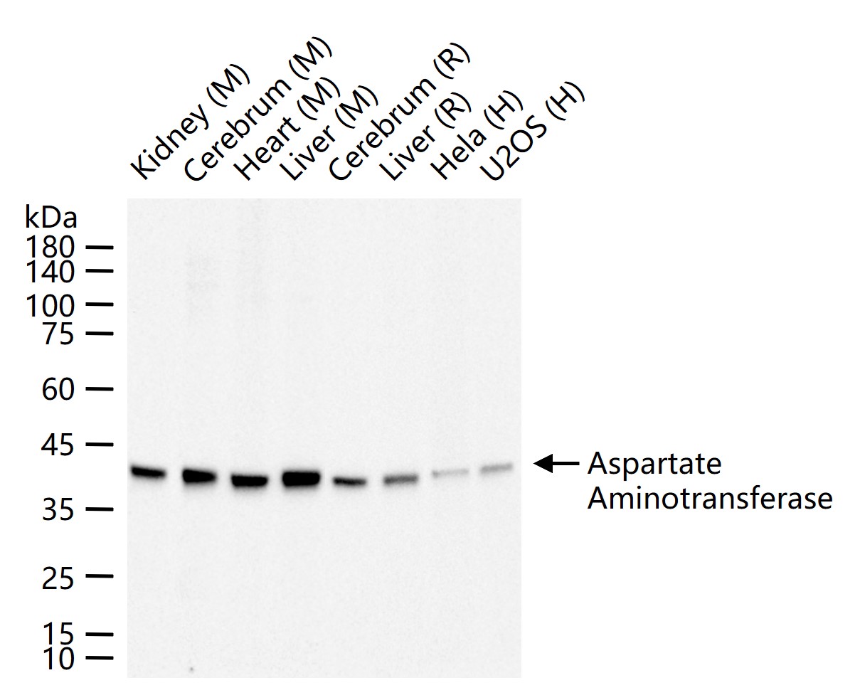 谷草转氨酶重组兔单抗-bsm-63078R