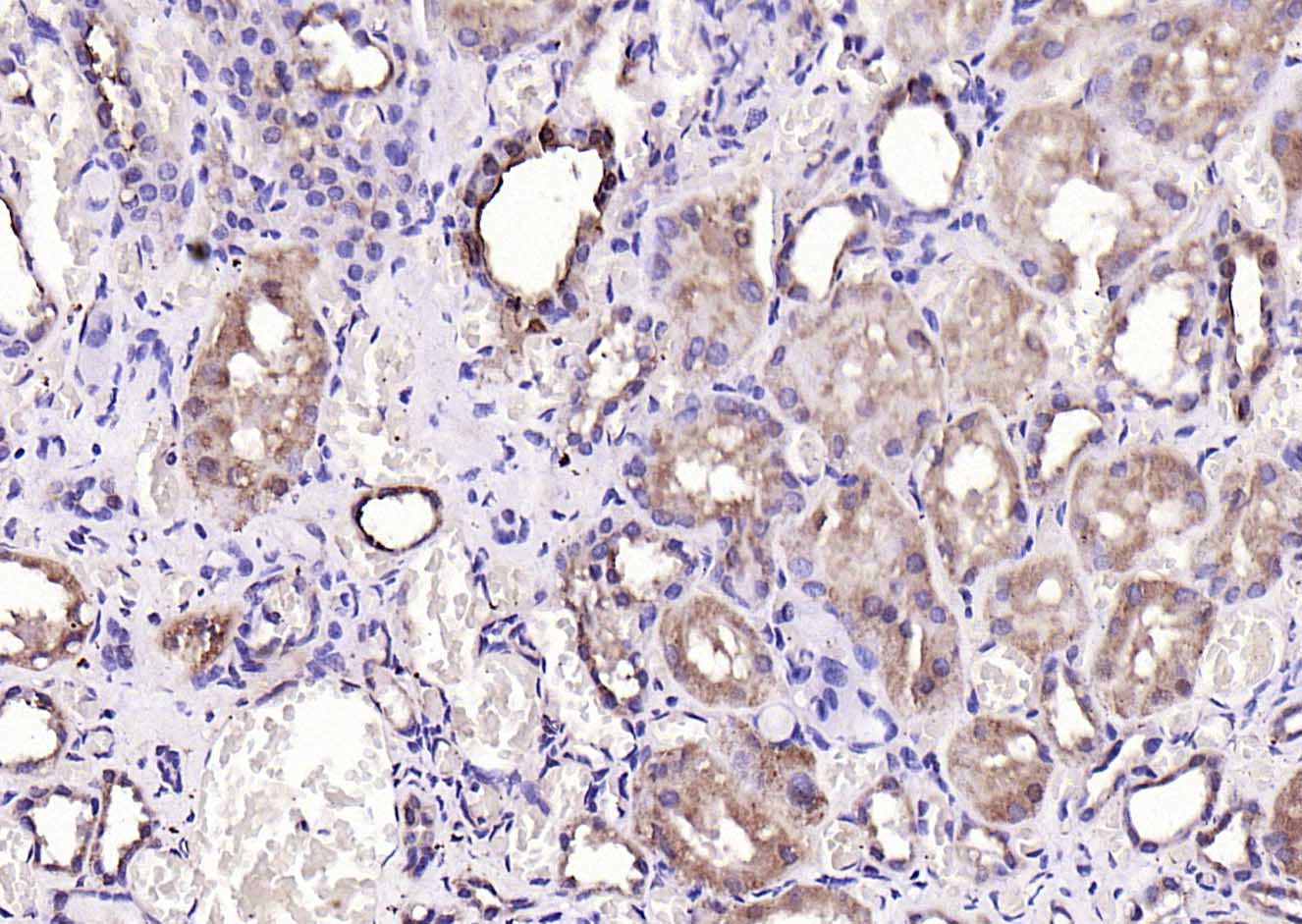 钙结合蛋白D28K抗体-bs-3758R