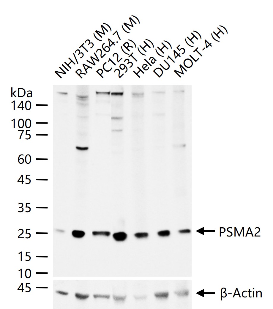 PSMA2 Recombinant Rabbit mAb (一抗) - WB,IHC-P,IHC-F,IF,Flow-Cyt,ICC/IF | Bioss