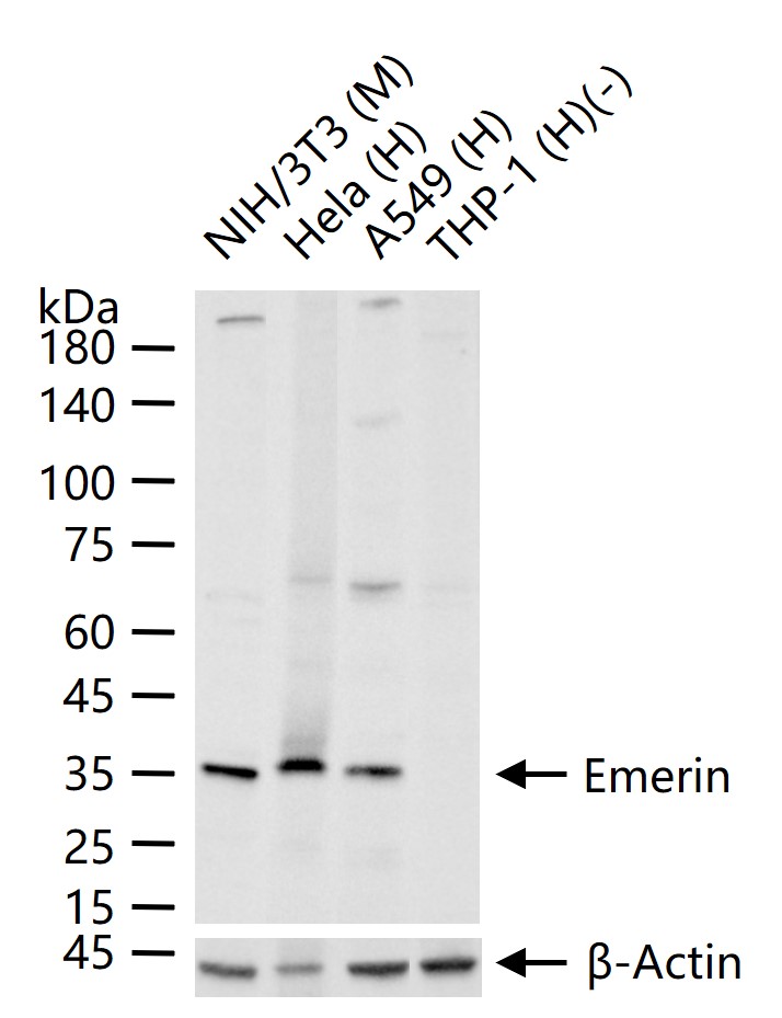 Emerin Recombinant Rabbit mAb (一抗) - WB,IHC-P,IHC-F,ICC/IF,IF | Bioss