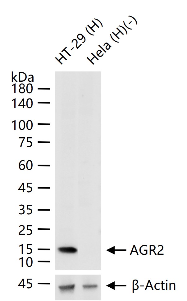 前梯度同源蛋白2重组兔单抗