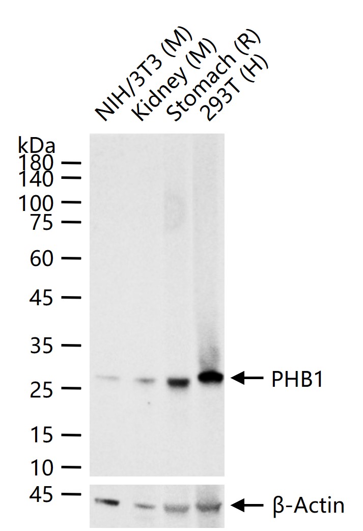 抗增殖蛋白1重组兔单抗-bsm-61208R