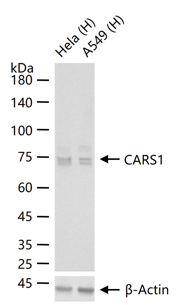 CARS1 Recombinant Rabbit mAb (一抗) - WB,IHC-P,IHC-F,IF,Flow-Cyt,ICC/IF | Bioss