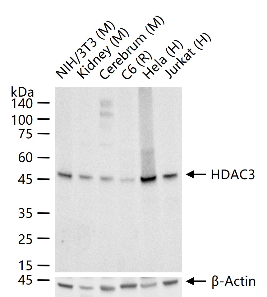 组蛋白去乙酰化酶3重组兔单抗