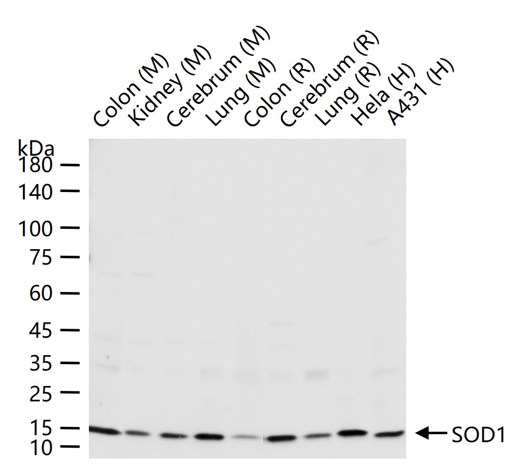 超氧化物歧化酶1重组兔单抗