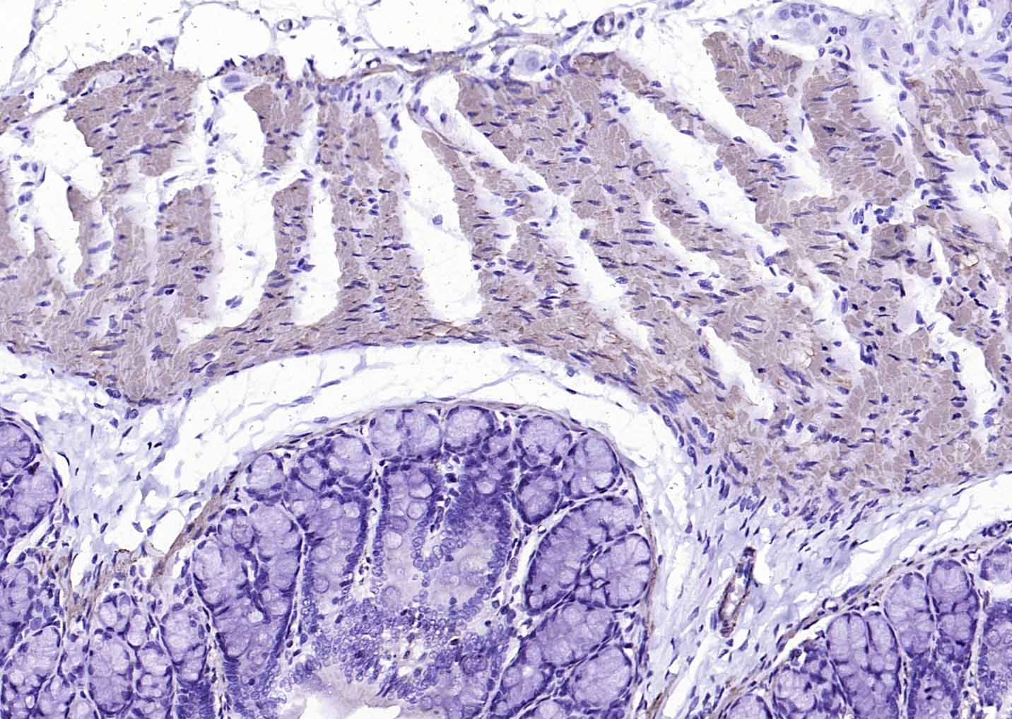 肌动蛋白α/α-SMA/α Actin单克隆抗体-bsm-33188M