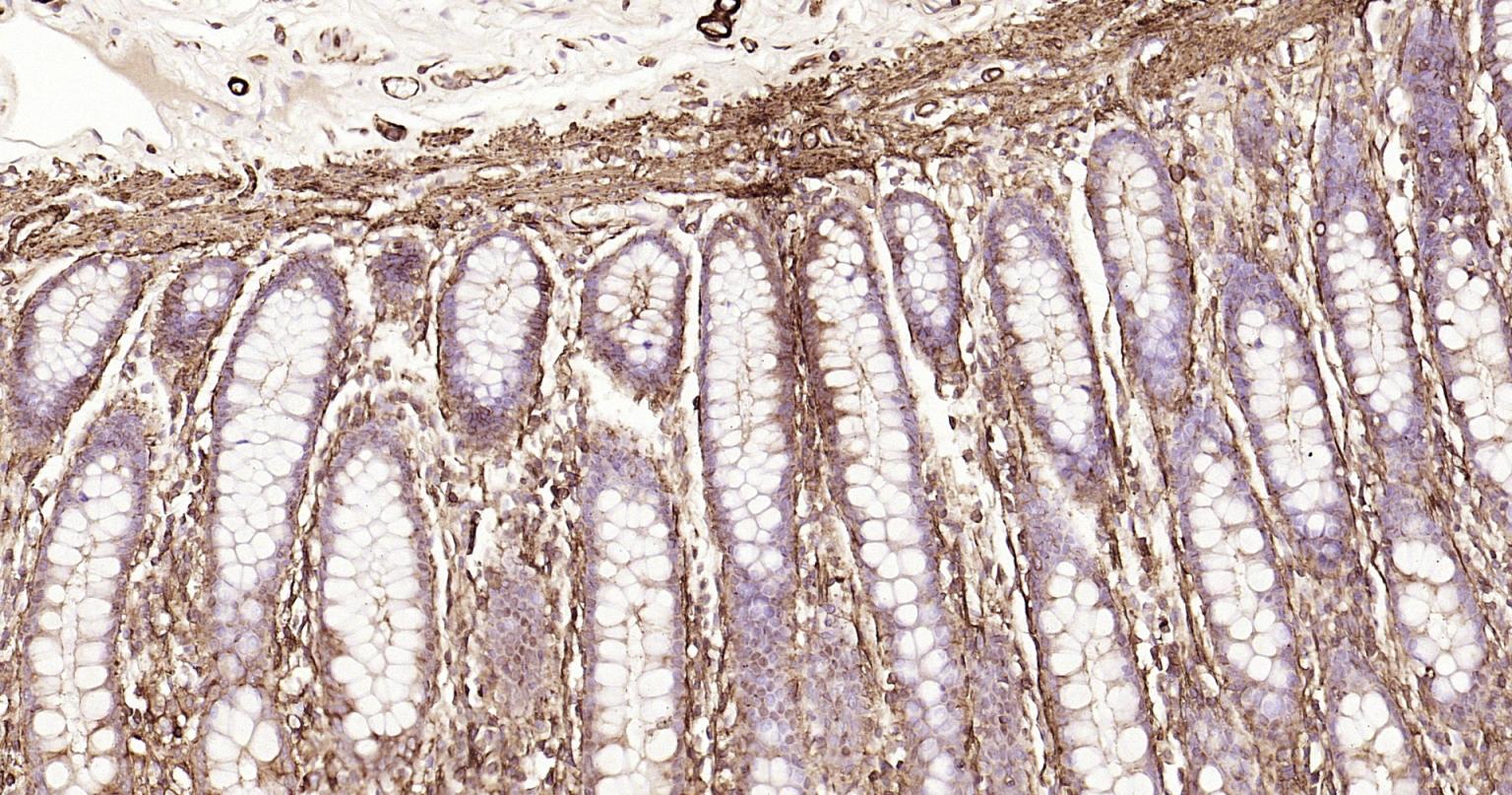 α-SMA重组兔单抗