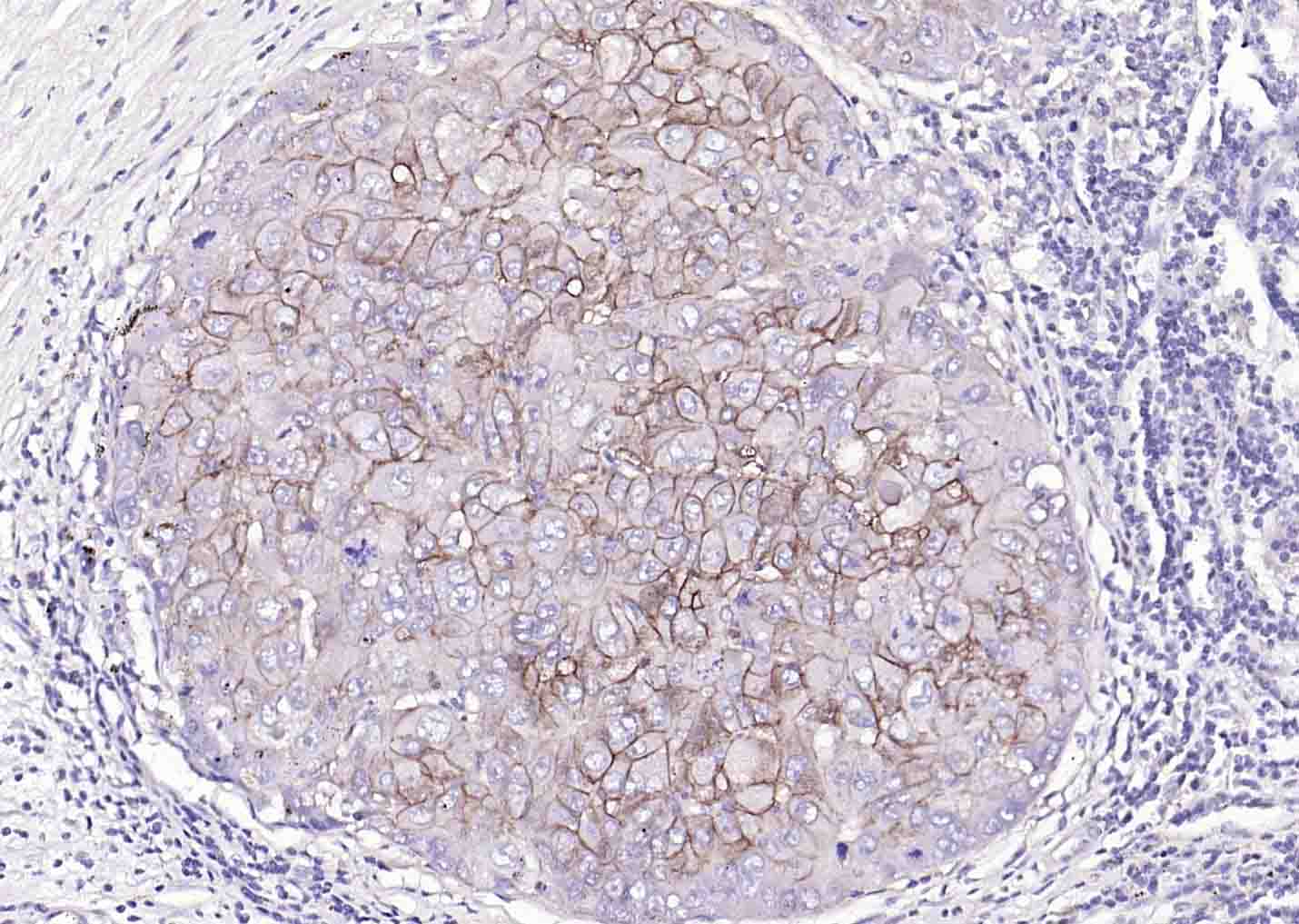 Na+/K+-ATPase α1 钠钾ATP酶α1抗体-bs-9570R