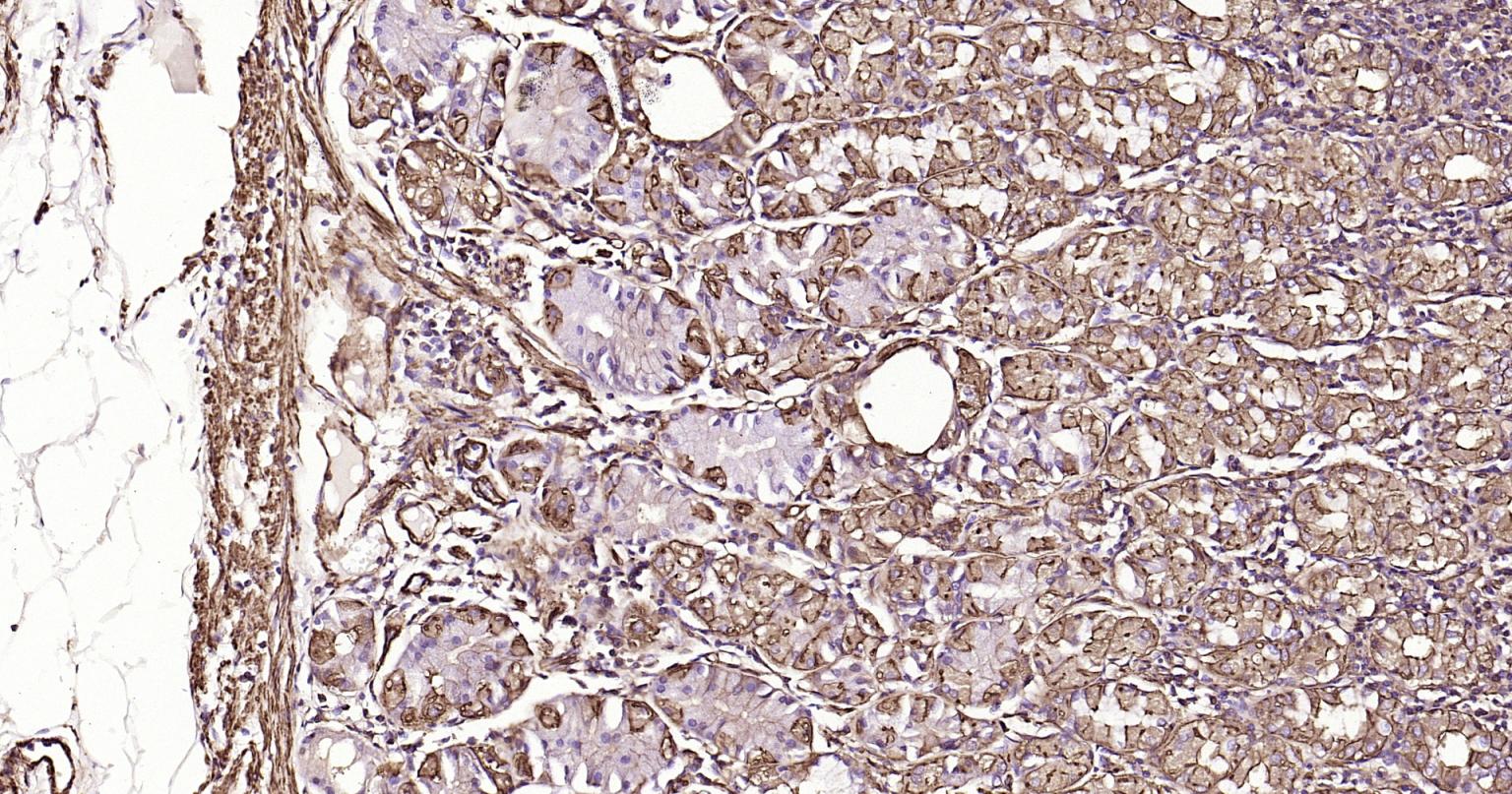 α-SMA重组兔单抗