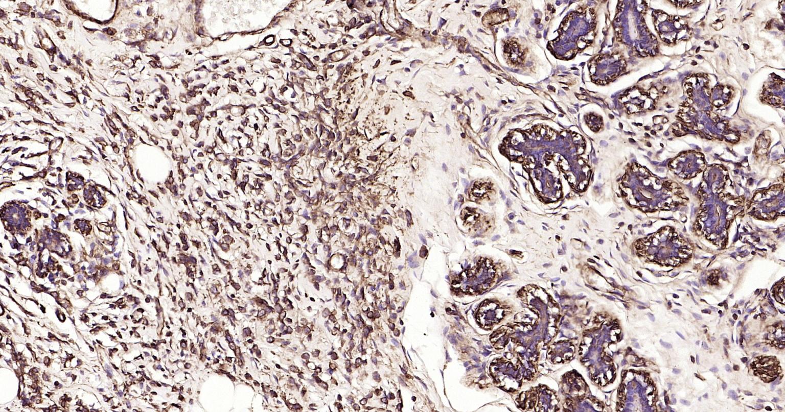 α-SMA重组兔单抗