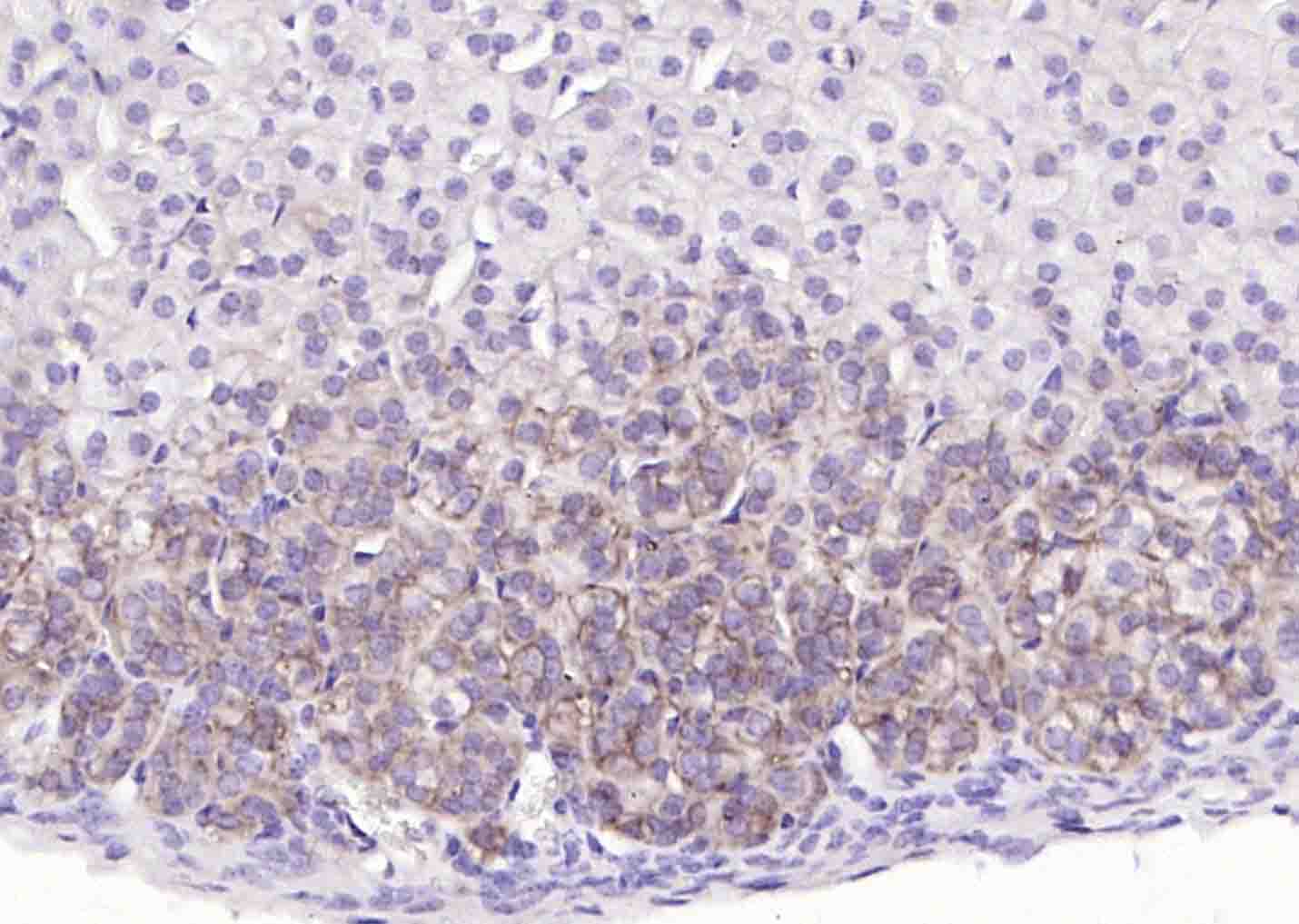 Na+/K+-ATPase α1 钠钾ATP酶α1抗体-bs-9570R