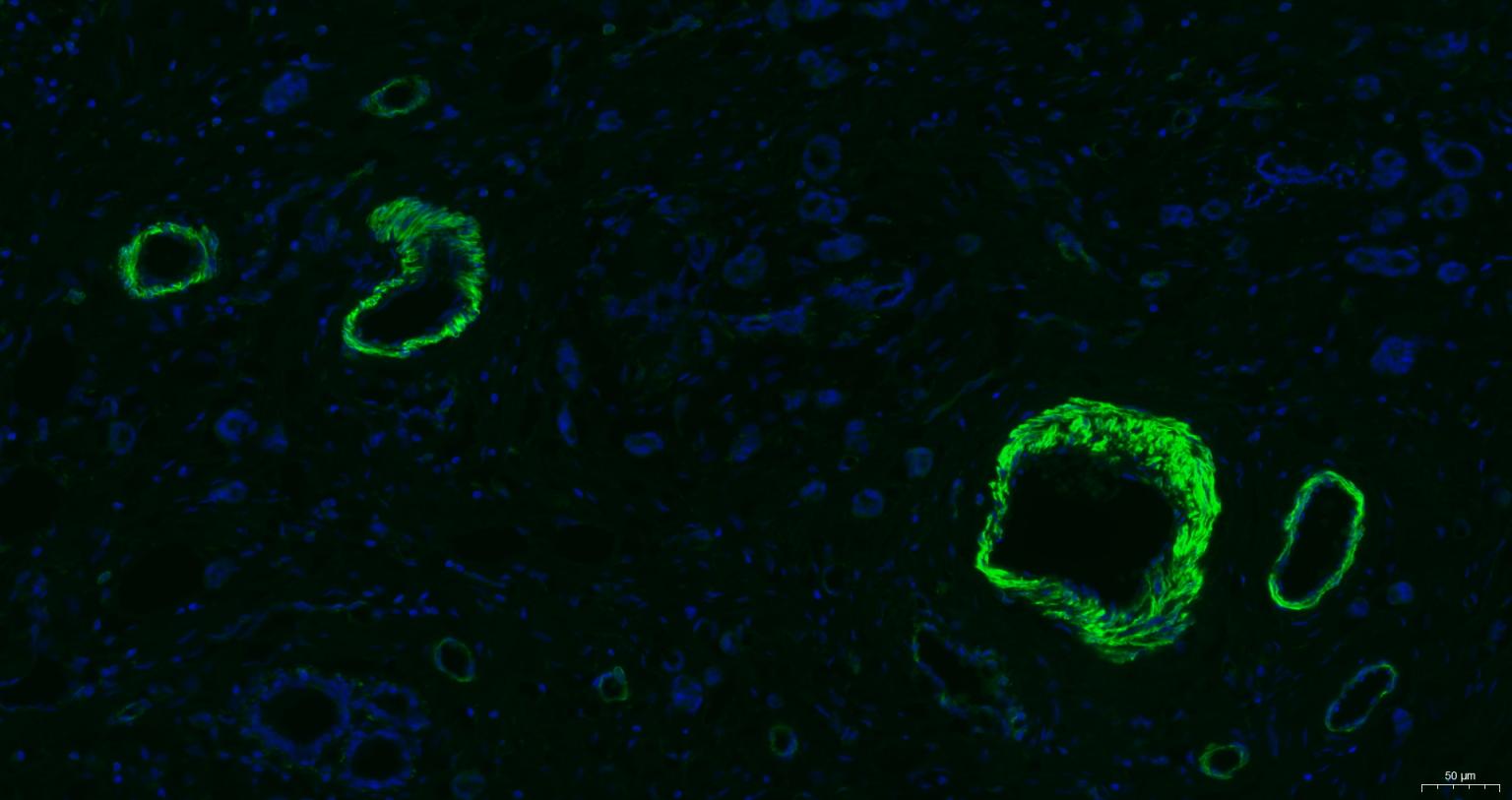 肌动蛋白α/α-SMA/α Actin单克隆抗体-bsm-33188M