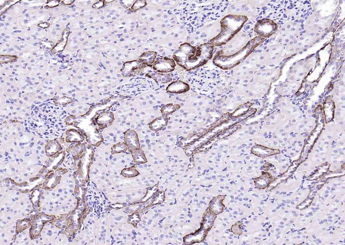 Na+/K+-ATPase α1 钠钾ATP酶α1抗体-bs-9570R