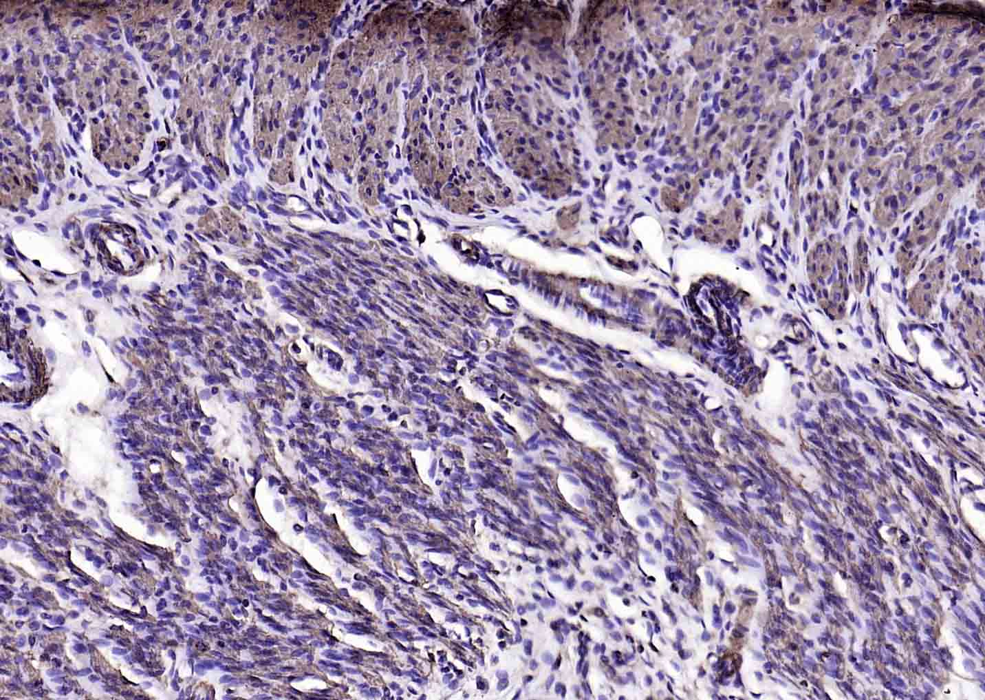 肌动蛋白α/α-SMA/α Actin单克隆抗体-bsm-33188M