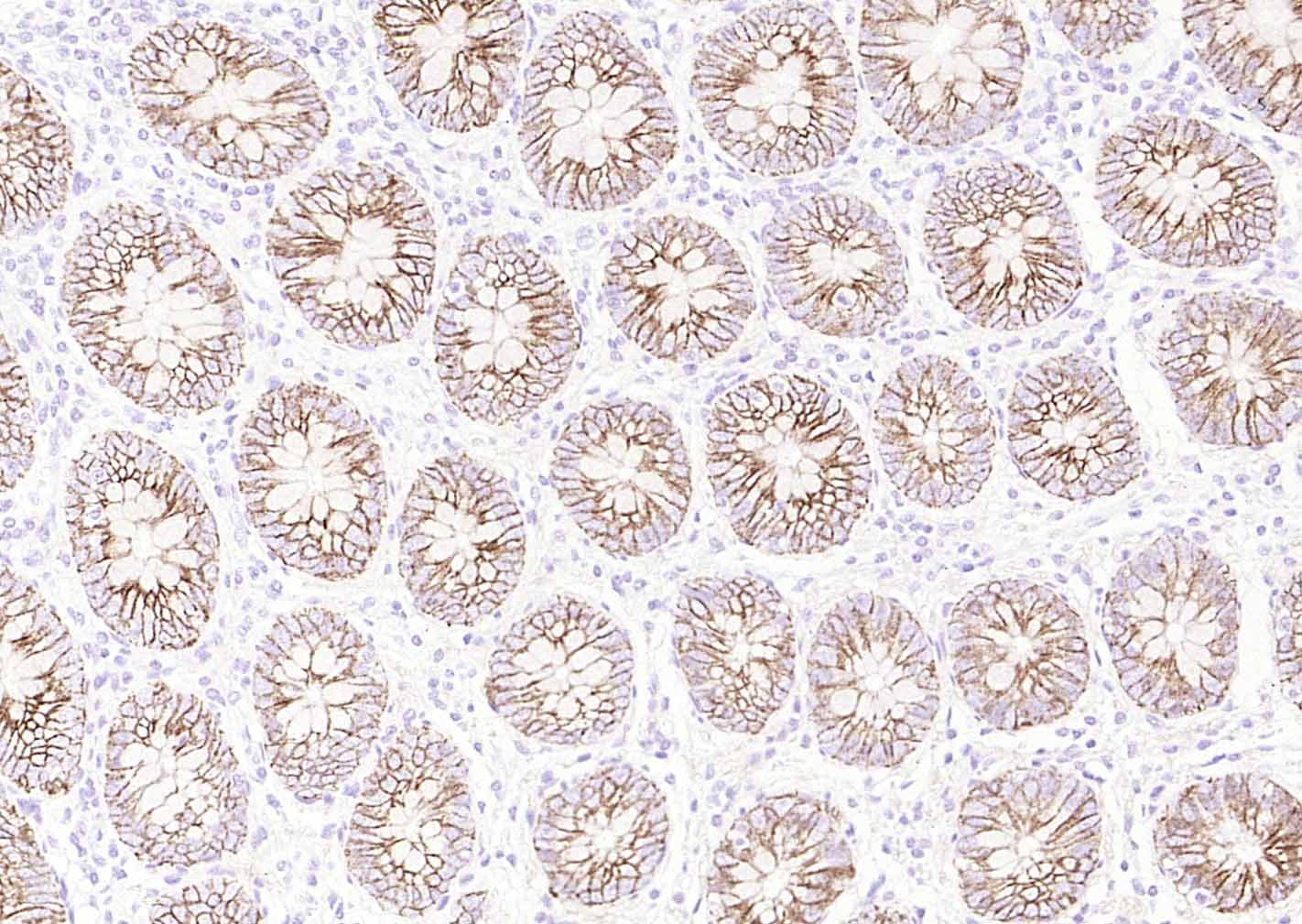 Na+/K+-ATPase α1 钠钾ATP酶α1抗体-bs-9570R