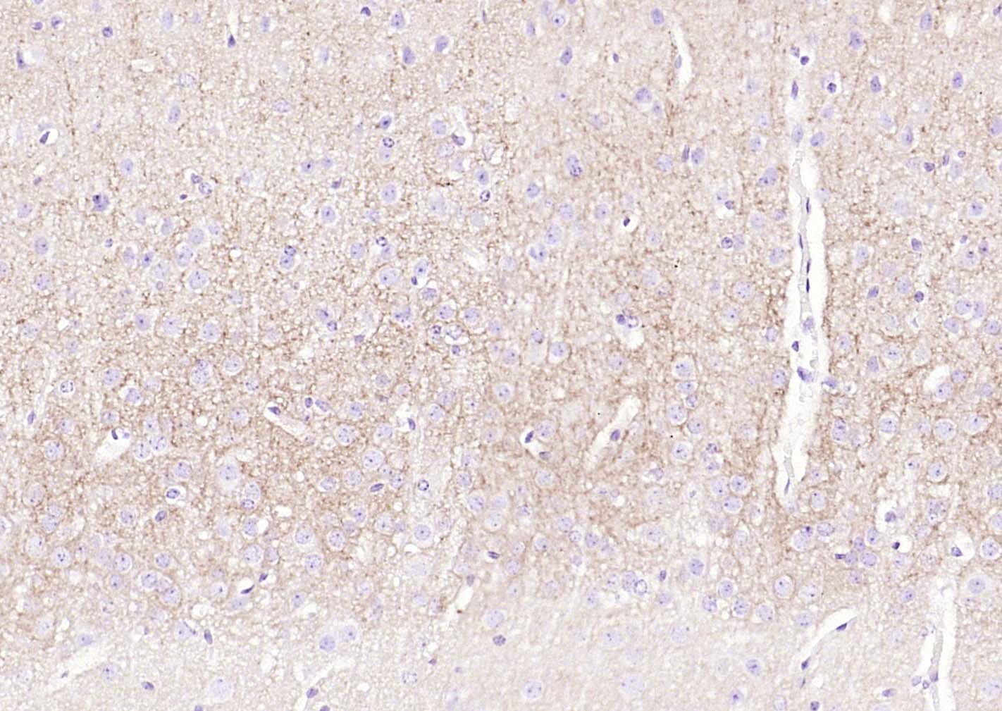 Na+/K+-ATPase α1 钠钾ATP酶α1抗体-bs-9570R