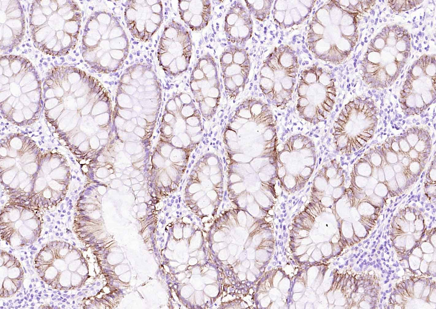 Na+/K+-ATPase α1 钠钾ATP酶α1抗体-bs-9570R