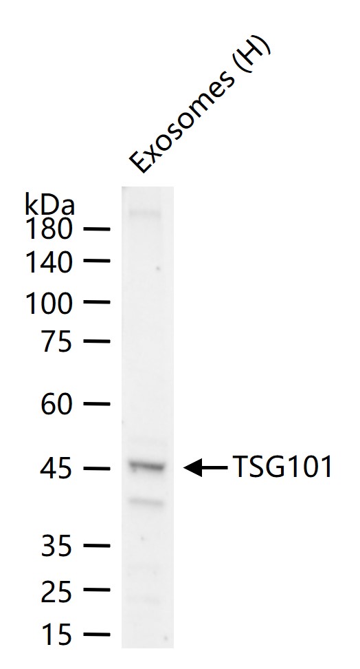 肿瘤易感基因101蛋白抗体