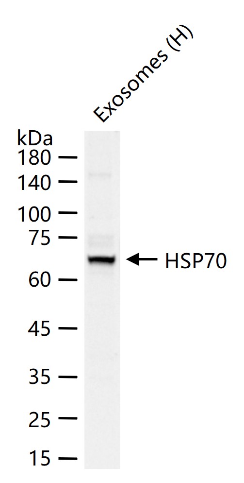 热休克蛋白-70抗体-bs-0126R