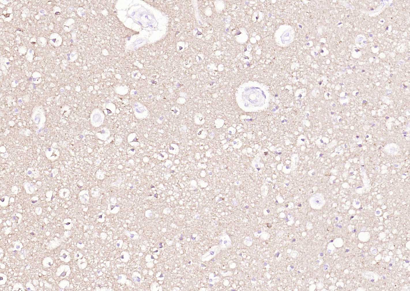 Na+/K+-ATPase α1 钠钾ATP酶α1抗体-bs-9570R