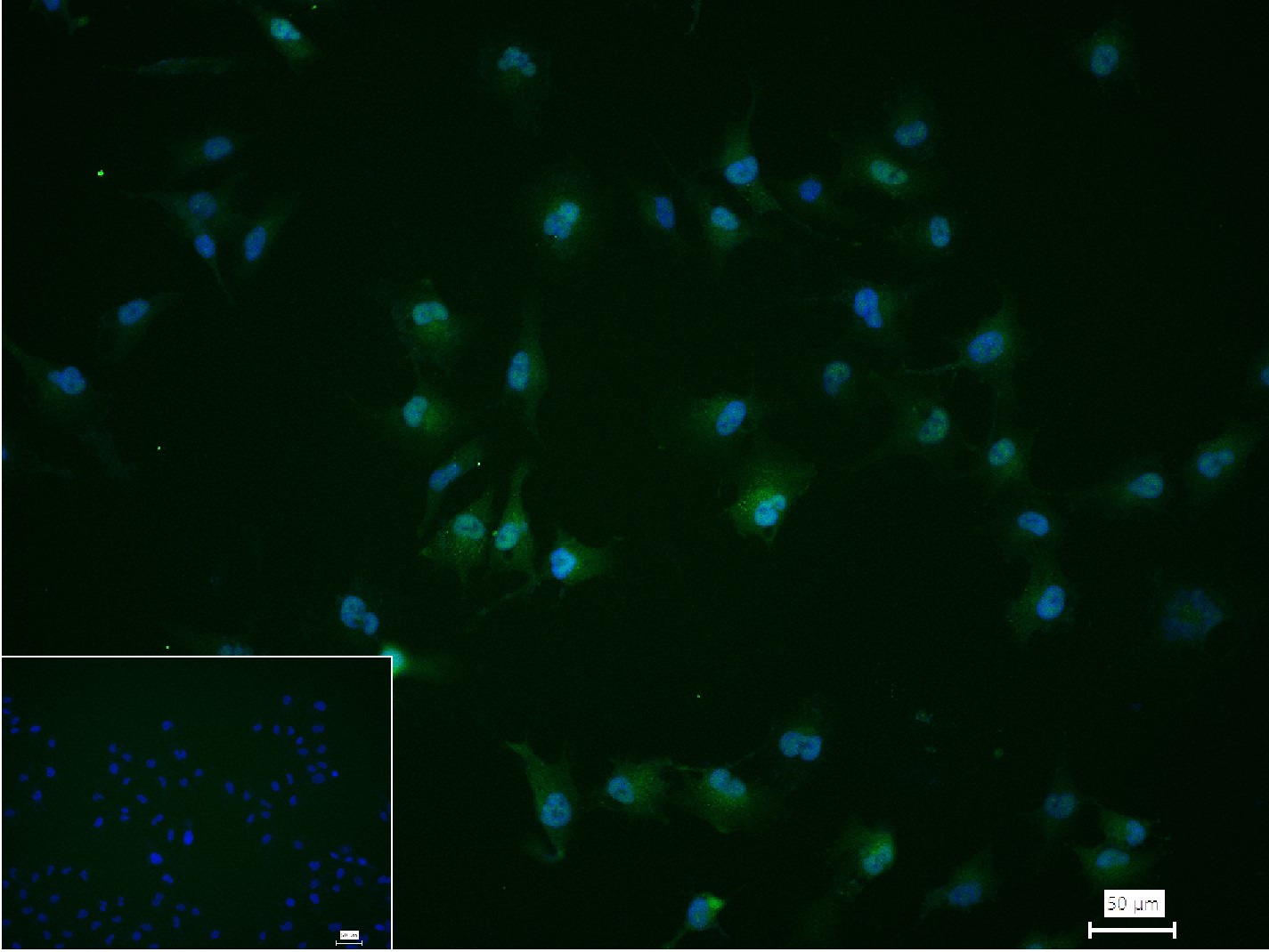 肌动蛋白相关蛋白2重组兔单抗