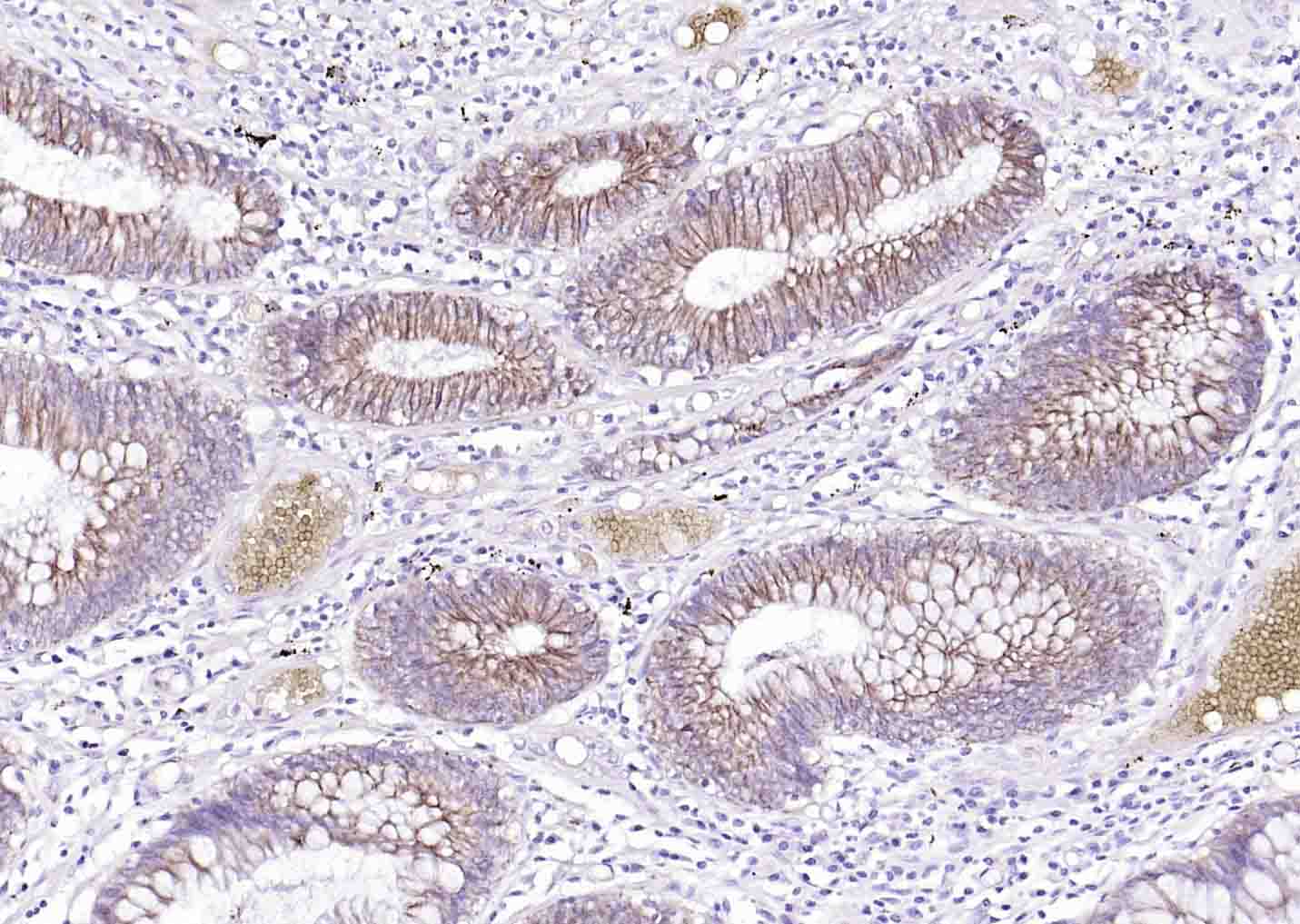 Na+/K+-ATPase α1 钠钾ATP酶α1抗体-bs-9570R